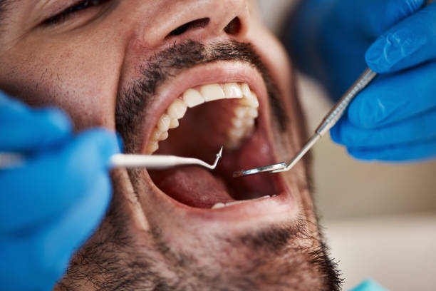 Best Emergency Dental Care  in Van, TX